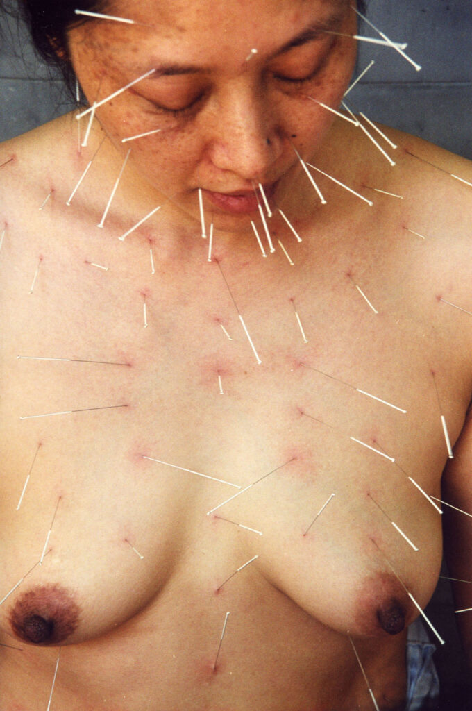 Photo titled "99 Needles" by He Chengyao